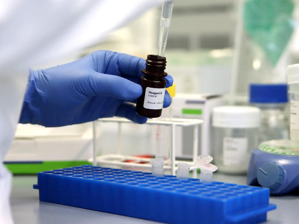 Fläschchen mit Mittel „Reagent D“ Multiplex-Assay: Legionellen durch PCR nachweisen