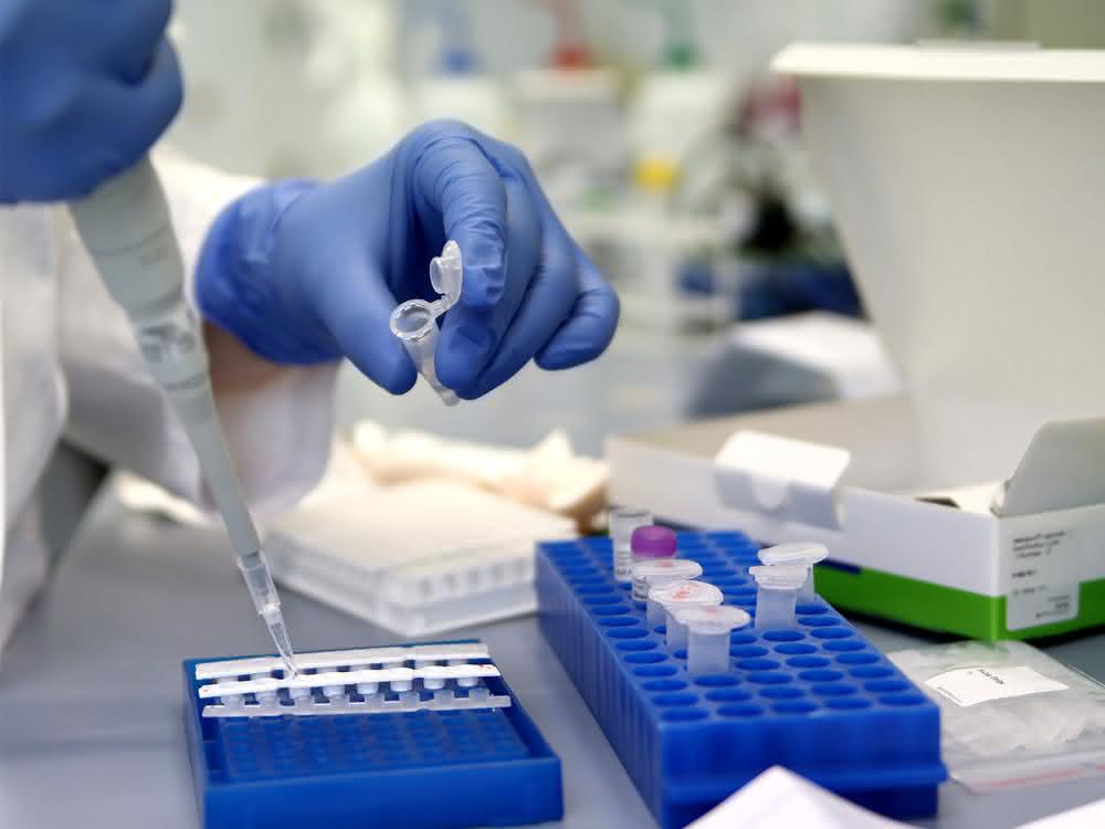 Multiplex-Assay: Legionellen durch PCR nachweisen Pipettieren einer Probe
