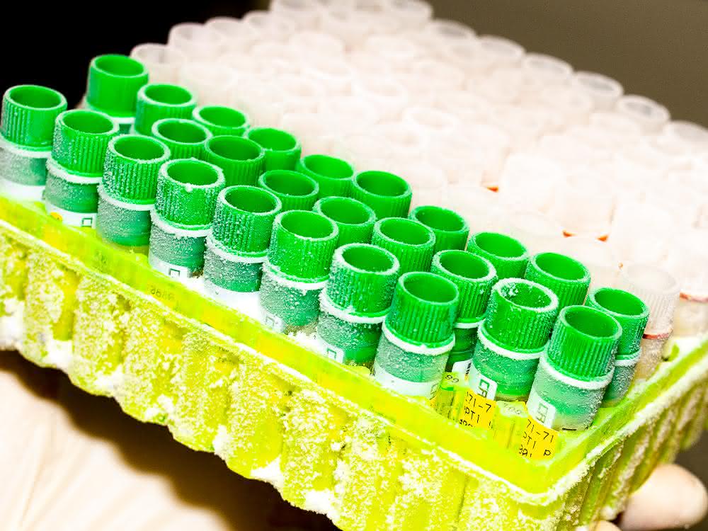 Cryobox mit eingefrorenen Tumorproben