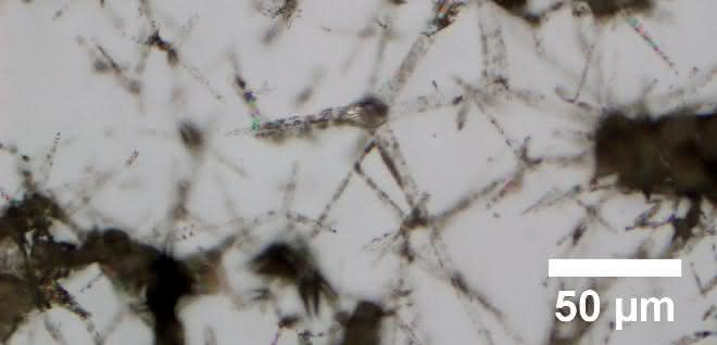 Das Hydrogel ist durchzogen von Mikrokanälen Mikroskopieaufnahme eines Hydrogels
