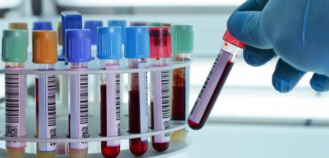 Branche zu Zeiten der Corona-Pandemie: Analytik und Diagnostik im Rampenlicht Barcode-beschriftete Röhrchen