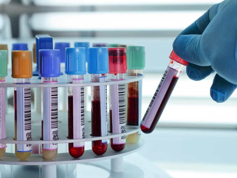 Branche zu Zeiten der Corona-Pandemie: Analytik und Diagnostik im Rampenlicht Barcode-beschriftete Röhrchen