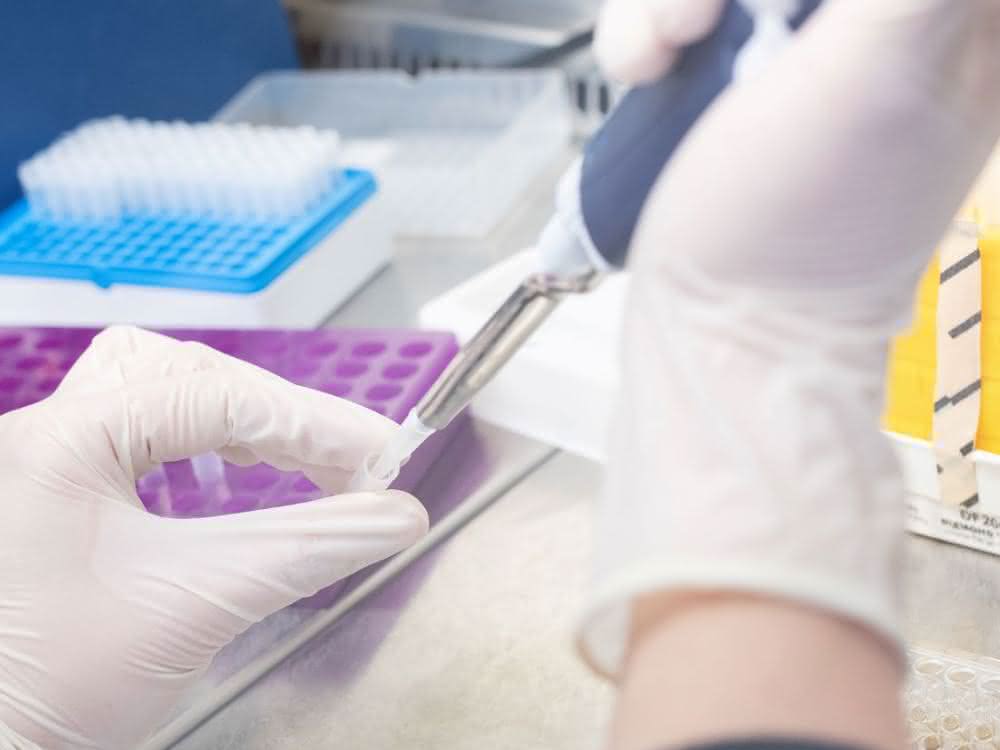 Am Ulmer Institut für Molekulare Virologie wird ein Labor-Experiment vorbereitet. Pipettiervorgang, Laborutensilien auf Labortisch