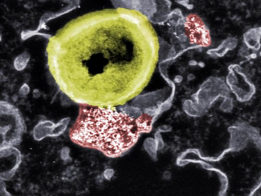 Kontakt Nanopartikel und resistente Bakterien