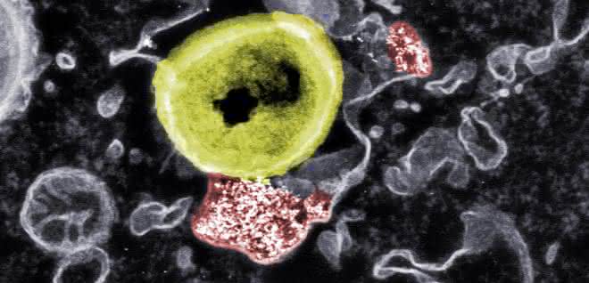 Nanopartikel (rot), die resistente Bakterien (gelb) abtöten können Kontakt Nanopartikel und resistente Bakterien
