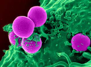 Antibiotika-resistente Bakterien Antibiotika-resistente Bakterien