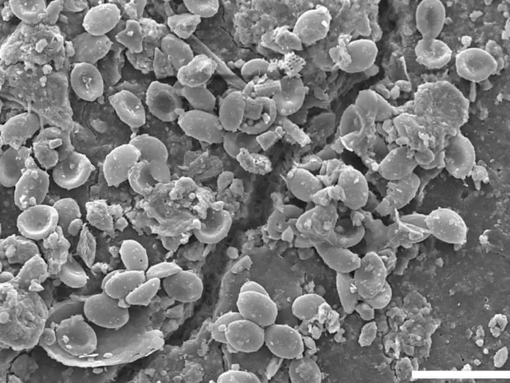 Pilzsporen entlang eines Risses in einem Mikroplastik-Partikel (rasterelektronenmikroskopische Aufnahme) Rasterelektronenmikroskopische Aufnahme (Pilzsporen an einem Mikroplastik-Partikel)