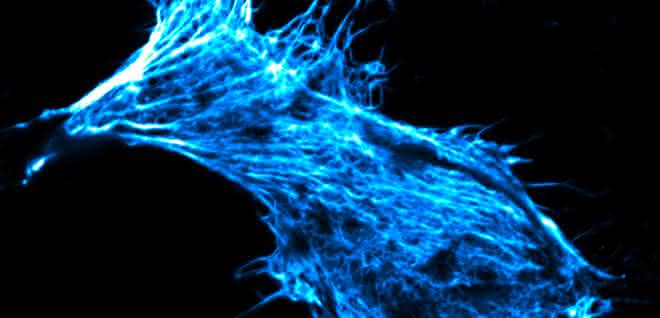 Krebszelle in Zellkultur, deren Skelett mit fluoreszierendem Phalloidin gefärbt ist.