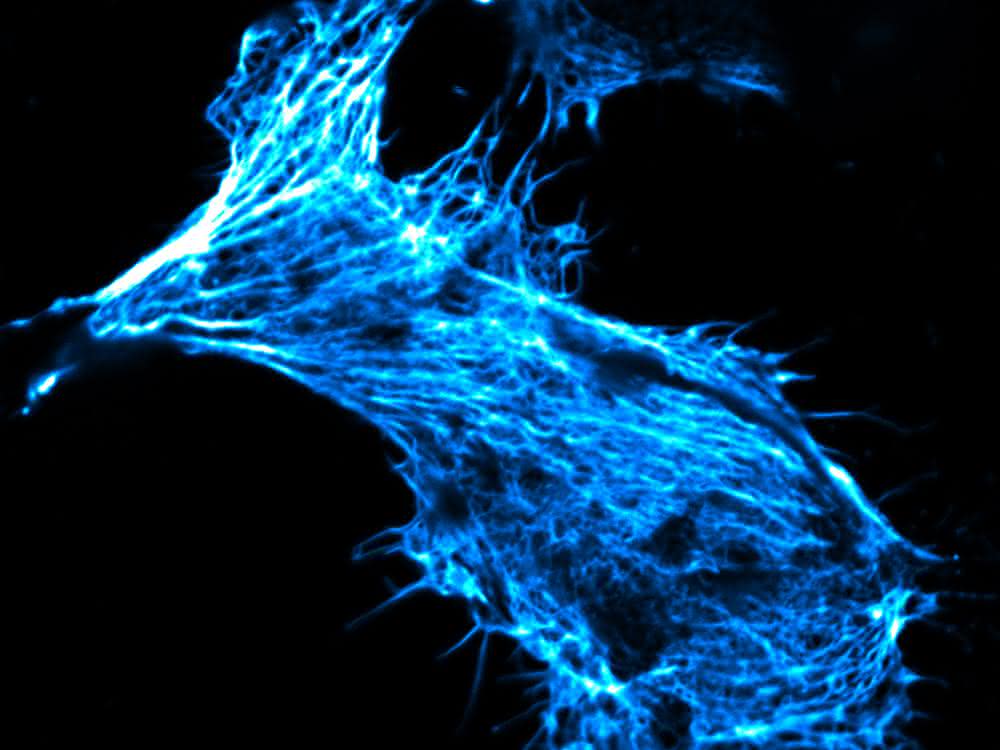 Krebszelle in Zellkultur, deren Skelett mit fluoreszierendem Phalloidin gefärbt ist.