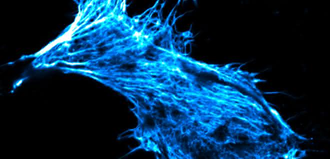 Krebszelle in Zellkultur, deren Skelett mit fluoreszierendem Phalloidin gefärbt ist.