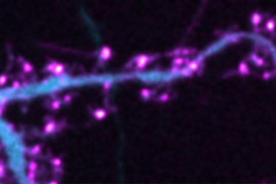 Fluoreszenzbild