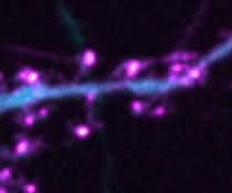 Fluoreszenzbild