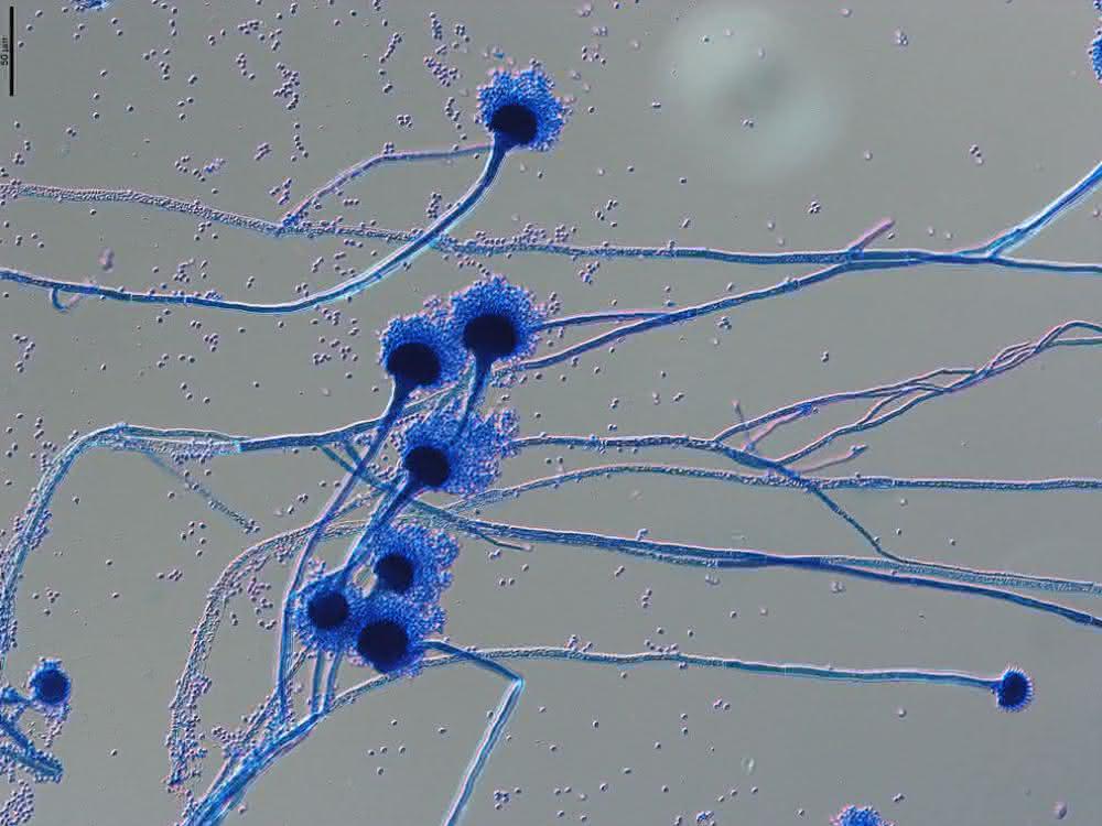Genomforschung: Pangenom eines verbreiteten Pilzes analysiert Sporenträger von Aspergillus fumigatus