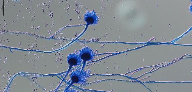 Genomforschung: Pangenom eines verbreiteten Pilzes analysiert Sporenträger von Aspergillus fumigatus