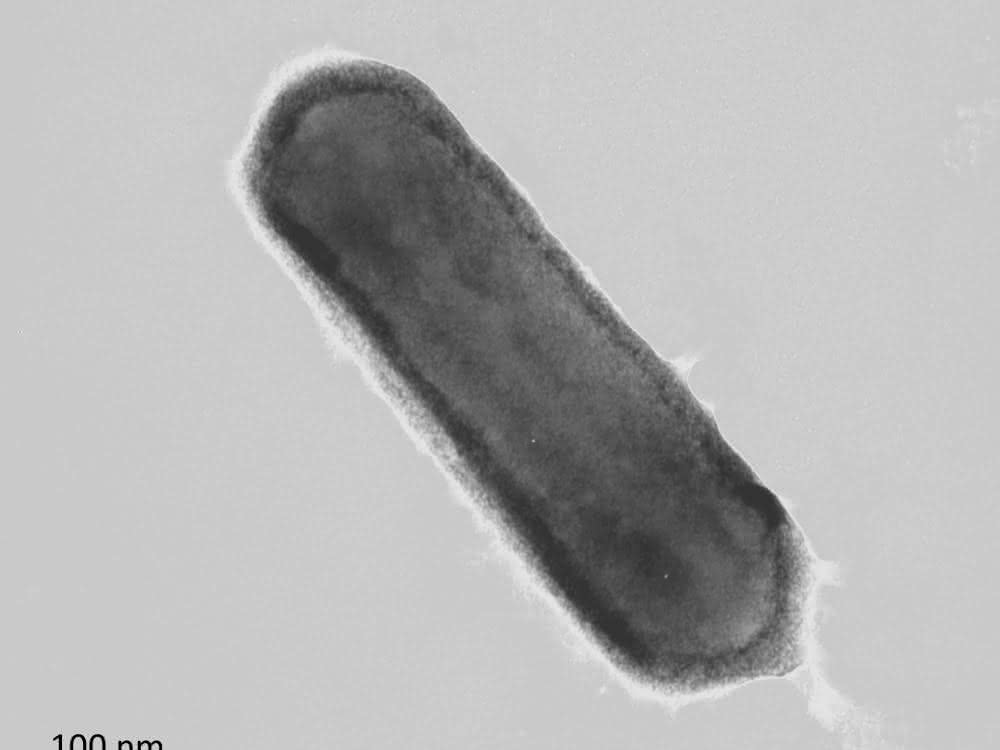 Nitrosopumilus maritimus (mikroskopische Aufnahme)