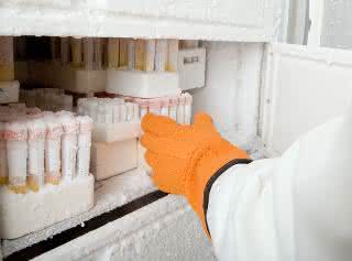 Proben im Tiefkühlschrank Proben im Tiefkühlschrank