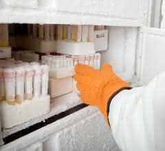 Proben im Tiefkühlschrank