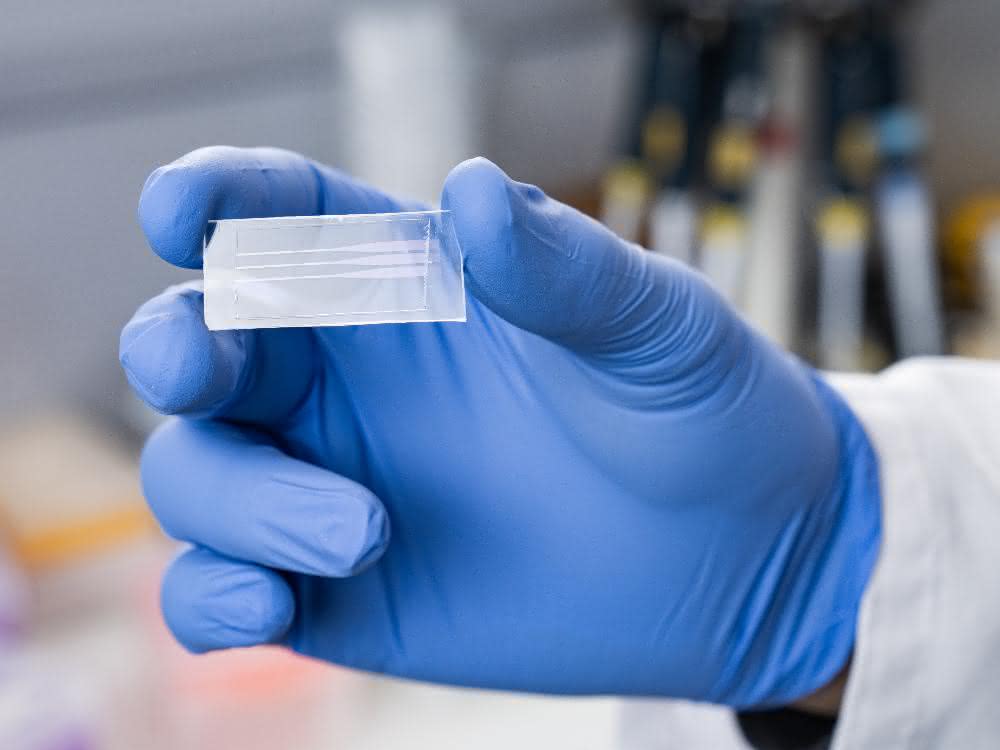 Lab-on-a-Chip: Neuartigen Coronavirus-Schnelltest entwickelt Test-Plättchen