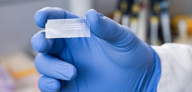 Lab-on-a-Chip: Neuartigen Coronavirus-Schnelltest entwickelt Test-Plättchen