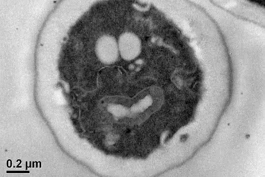Zelle der Hefe Saccharomyces cerevisiae mit sichtbaren Zellorganellen