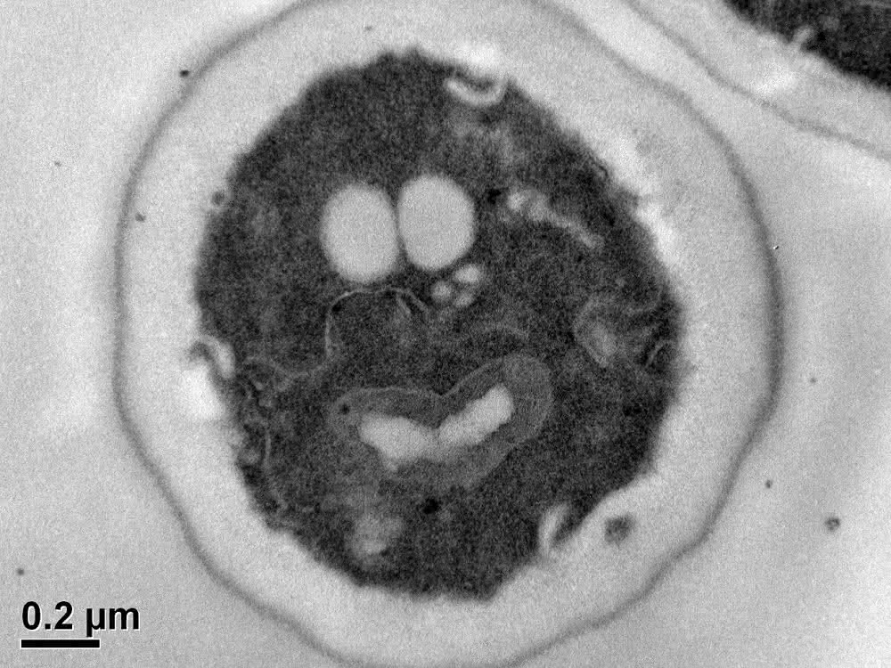 Zelle der Hefe Saccharomyces cerevisiae mit sichtbaren Zellorganellen