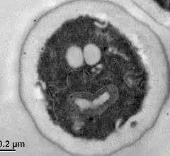 Hefe gekürt: Mikrobe des Jahres 2022 Zelle der Hefe Saccharomyces cerevisiae mit sichtbaren Zellorganellen