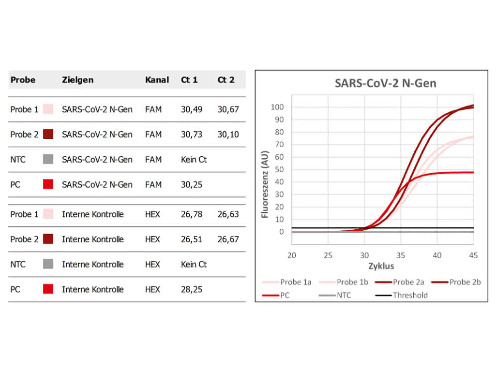 Workflow mit integriertem Liquid-Handling-System: SARS-CoV-2 in Abwässern nachweisen Exemplarische Analyseergebnisse für zwei Abwasserproben