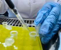 Pipettiervorgang im Labor