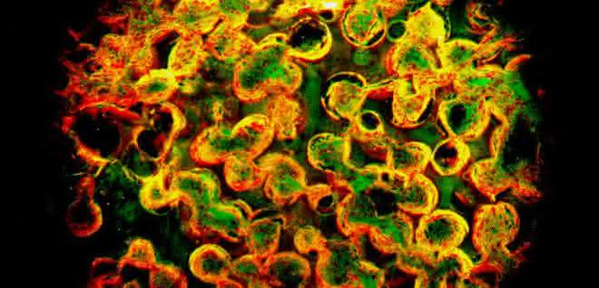 Großporige Hydrogele als Träger für Nanosensoren für die Diagnostik: Goldnanopartikel, die unter die Haut „gehen“ Goldnanopartikel in einem porösen Hydrogel
