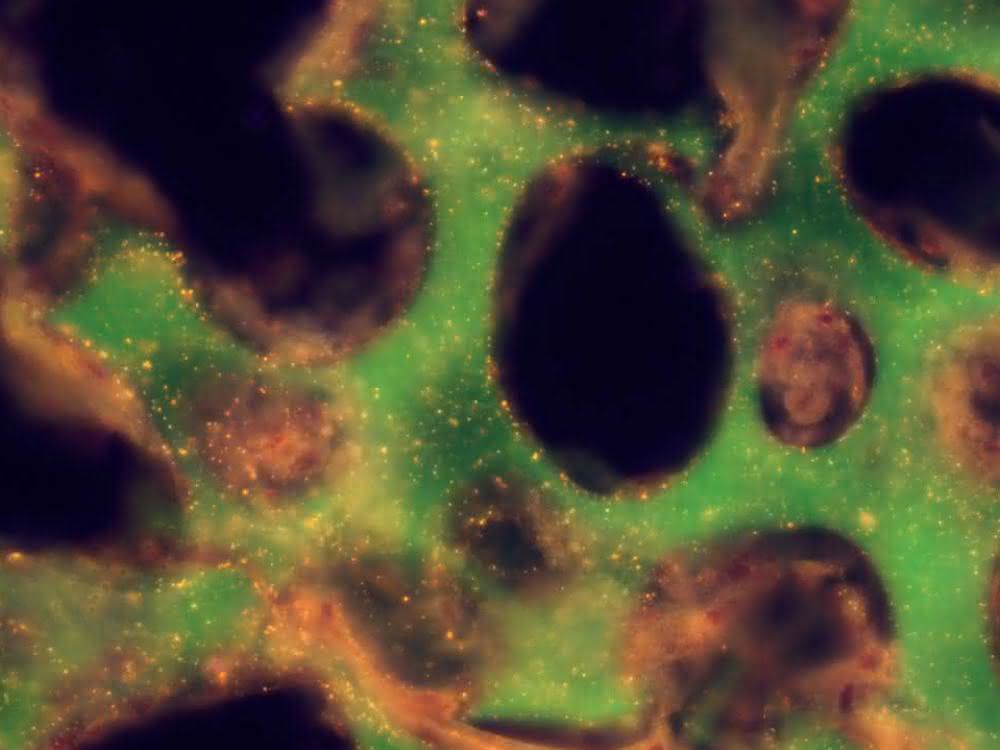 Großporige Hydrogele als Träger für Nanosensoren für die Diagnostik: Goldnanopartikel, die unter die Haut „gehen“ Histologische Probe des Sensors