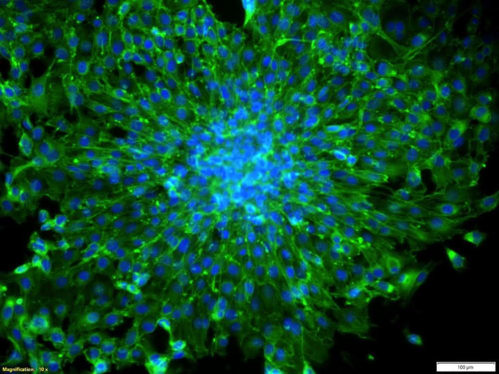 Von der Einzelzelle bis zum Organoid: Prozessketten zur Isolation und Analyse