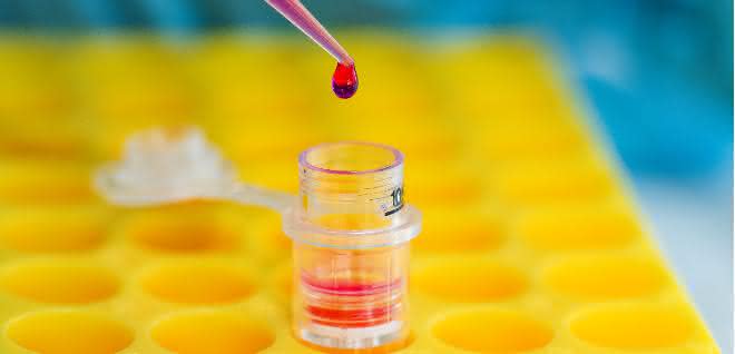 Forensik: Körpersekrete mit Proteinanalysen unterscheiden Forensik: Körpersekrete mit Proteinanalysen unterscheiden