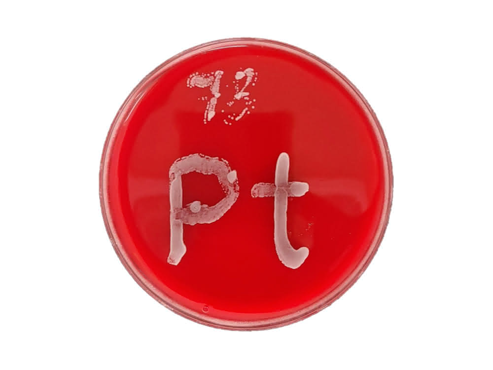 Chemie und Wirkstoffforschung: Metallverbindungen gegen Pilzinfektionen Eine Petrischale mit rotem Agar, auf dem ein Pilzstrang wächst (hier gezielt angesetzt in der Form des Elementsymbols für Platin).