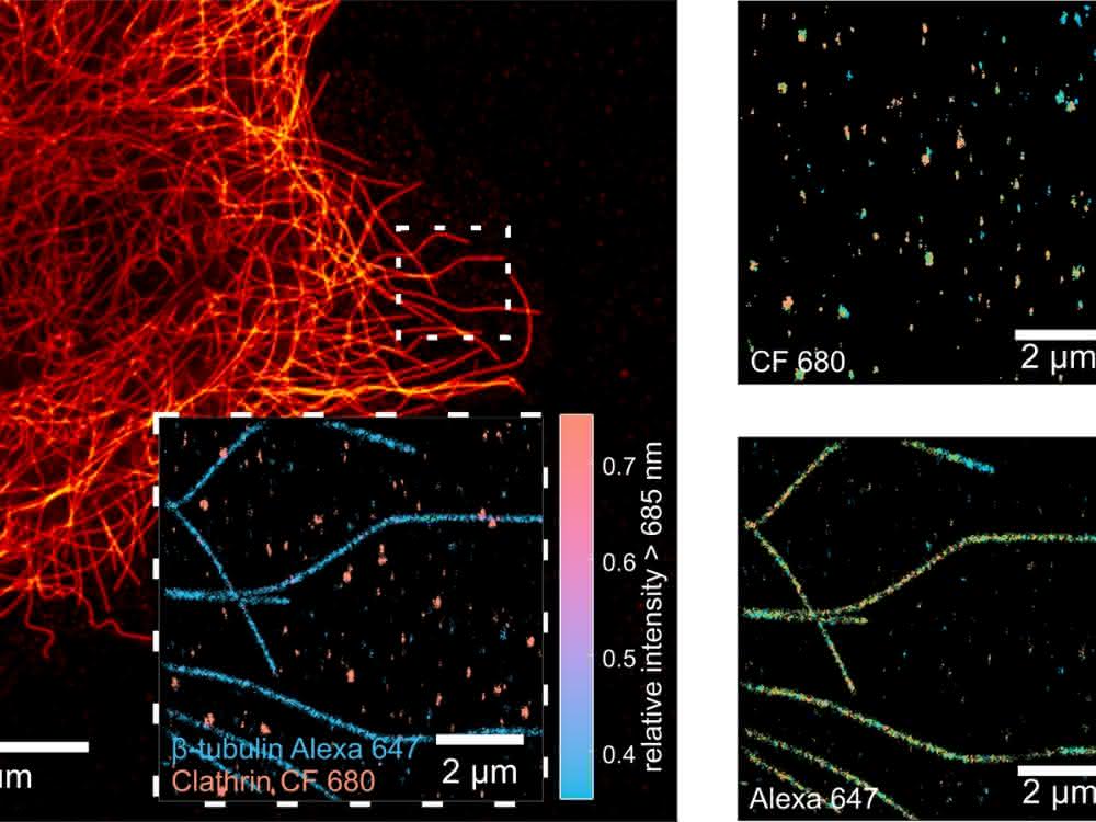 Kombinierte Mikroskopietechniken: Isotrope dreidimensionale Superauflösung erreichen