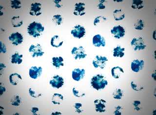CRISPR-Cas-System eines Bakteriums: Gen-Hemmung statt Gen-Schere