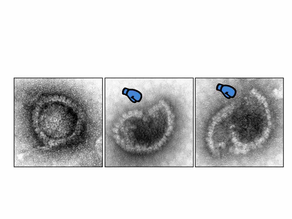 Lädierung eines Herpesvirus (Elektronenmikroskopische Aufnahmen)