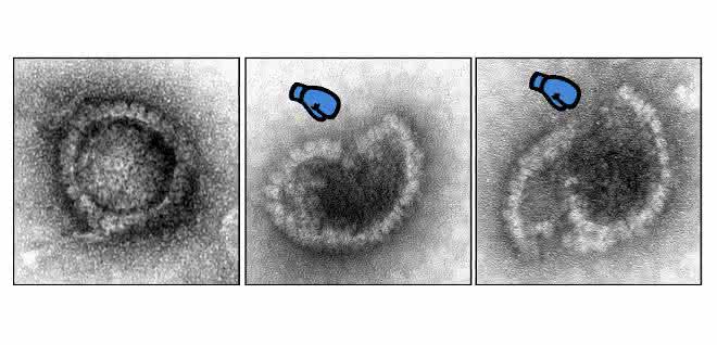 Lädierung eines Herpesvirus (Elektronenmikroskopische Aufnahmen)
