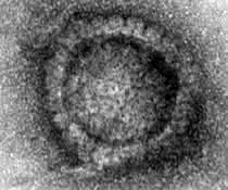 Lädierung eines Herpesvirus (Elektronenmikroskopische Aufnahmen)
