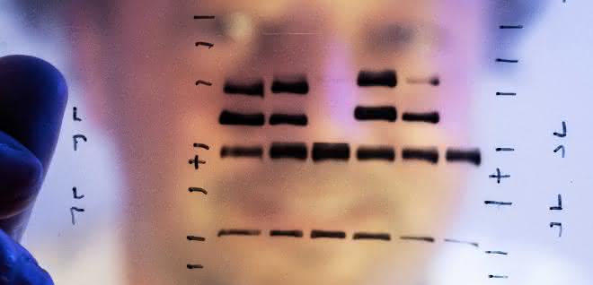In Laborversuchen getestet: Enzyminhibitor kann Tumorwachstum verlangsamen PD Dr. Christian Kosan, Universität Jena
