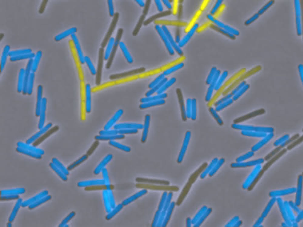 Vielseitiger Bacillus: Mikrobe des Jahres 2023