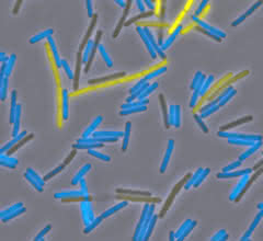 Vielseitiger Bacillus: Mikrobe des Jahres 2023 Vielseitiger Bacillus: Mikrobe des Jahres 2023