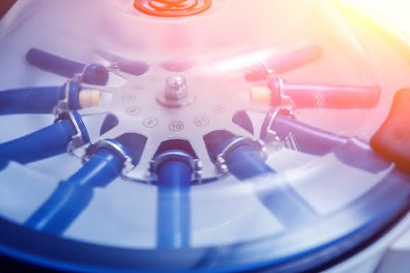 Blick in die Technik: Was treibt die Zentrifuge an?